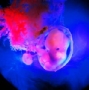 embryo1.html